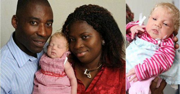 Sněhurka se narodila v nigerijské rodině před 10 lety, jak vypadá nyní?