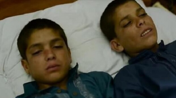 Během dne jsou tito bratři normálními dětmi, ale v noci se s jejich těly děje něco, co ani lékaři nedokáží vysvětlit
