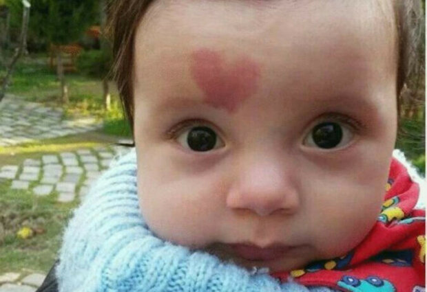 Jak nyní vypadá chlapec, který se narodil s mateřským znaménkem ve tvaru srdce na čele?