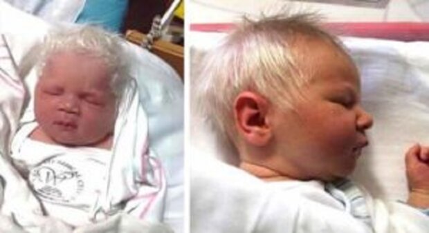 Dítě se narodilo s úplně šedými vlasy. Rodiče tomu nemohli uvěřit, když jim doktor řekl proč tomu tak je